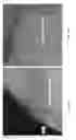 Fig. 10 - Minced Cartilage Systems and Methods