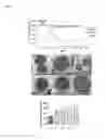Fig. 15 - Method for identifying bacteria for bacteriotherapy