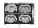 Fig. 04 - METHOD OF IMPROVING HEMATOLOGICAL PARAMETERS AND BRAIN DYSFUNCTION WITH GANODERMA TSUGAE EXTRACT