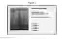 Fig. 04 - NOVEL COMPOSITION FOR TREATING ALZHEIMER'S DISEASE AND IMPROVING COGNITIVE FUNCTION OF ALZHEIMER'S PATIENTS