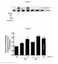 Fig. 10 - NOVEL COMPOSITION FOR TREATING ALZHEIMER'S DISEASE AND IMPROVING COGNITIVE FUNCTION OF ALZHEIMER'S PATIENTS