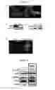 Fig. 15 - NOVEL COMPOSITION FOR TREATING ALZHEIMER'S DISEASE AND IMPROVING COGNITIVE FUNCTION OF ALZHEIMER'S PATIENTS