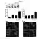Fig. 16 - NOVEL COMPOSITION FOR TREATING ALZHEIMER'S DISEASE AND IMPROVING COGNITIVE FUNCTION OF ALZHEIMER'S PATIENTS