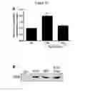 Fig. 20 - NOVEL COMPOSITION FOR TREATING ALZHEIMER'S DISEASE AND IMPROVING COGNITIVE FUNCTION OF ALZHEIMER'S PATIENTS