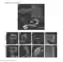 Fig. 03 - THERAPEUTIC METHODS FOR TREATING SOLID TUMORS AND RELATED DIAGNOSTIC METHODS