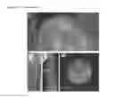 Fig. 08 - THERAPEUTIC METHODS FOR TREATING SOLID TUMORS AND RELATED DIAGNOSTIC METHODS