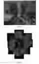 Fig. 02 - COMPOSTIONS AND METHODS FOR TREATING RETINAL DISEASE
