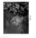 Fig. 05 - COMPOSTIONS AND METHODS FOR TREATING RETINAL DISEASE