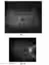 Fig. 06 - COMPOSTIONS AND METHODS FOR TREATING RETINAL DISEASE