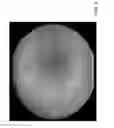 Fig. 07 - COMPOSTIONS AND METHODS FOR TREATING RETINAL DISEASE