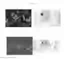 Fig. 08 - A METHOD FOR TREATING TUMOR BY USING RECOMBINANT INTERFERON WITH CHANGED SPATIAL CONFIGURATION