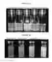 Fig. 07 - COMPOSITIONS AND METHODS FOR TREATING GLUTEN INTOLERANCE AND DISORDERS ARISING THEREFROM