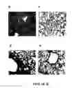 Fig. 10 - Rapid and prolonged immunologic-therapeutic