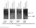 Fig. 06 - Vaccines against multiple subtypes of dengue virus