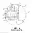 Fig. 04 - MEDICAL IMPLANT