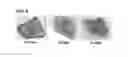 Fig. 06 - Albumin conjugated temperature and pH-sensitive multi-block copolymer, a method of preparation thereof and drug delivery system using the same