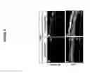Fig. 05 - MiR-204 and miR-211 and uses thereof