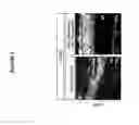 Fig. 06 - MiR-204 and miR-211 and uses thereof