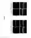 Fig. 09 - MiR-204 and miR-211 and uses thereof