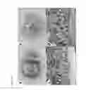 Fig. 11 - TISSUE ENGINEERED INTESTINE