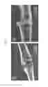 Fig. 03 - Magnesium alloy with adjustable degradation rate
