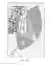 Fig. 29 - Negative pressure wound closure device and systems and methods of use in treating wounds with negative pressure