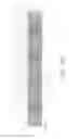 Fig. 41 - Negative pressure wound closure device and systems and methods of use in treating wounds with negative pressure