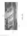 Fig. 47 - Negative pressure wound closure device and systems and methods of use in treating wounds with negative pressure