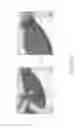 Fig. 56 - Negative pressure wound closure device and systems and methods of use in treating wounds with negative pressure