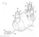 Fig. 01 - Total artificial heart
