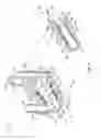 Fig. 03 - Total artificial heart