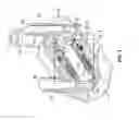 Fig. 04 - Total artificial heart