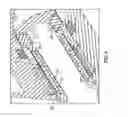 Fig. 05 - Total artificial heart