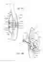 Fig. 17 - Thoracic aorta ventricular assist system