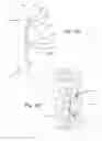Fig. 25 - Thoracic aorta ventricular assist system