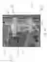 Fig. 09 - Dialyzer holder and improved airless bloodline priming method