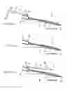 Fig. 04 - Indwelling assembly