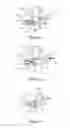 Fig. 03 - Devices and methods for delivering particles
