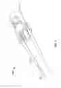 Fig. 04 - VEIN STABILIZER DEVICE