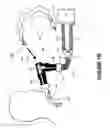 Fig. 03 - Catheter mount with suction port