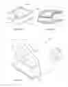 Fig. 35 - Humidifier reservoir