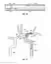 Fig. 08 - Intraluminal devices and systems