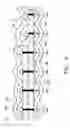 Fig. 05 - Device and Method for the Ablation of Fibrin Sheath Formation on a Venous Catheter