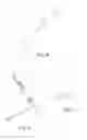 Fig. 04 - Catheter assembly