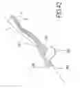 Fig. 25 - Intravenous catheter insertion and blood sample devices and method of use