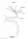 Fig. 02 - System and methods for intracranial vessel access