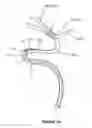 Fig. 04 - System and methods for intracranial vessel access