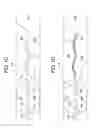 Fig. 03 - Supportive balloon catheter