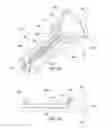 Fig. 08 - Drug delivery device and methods having a retaining member