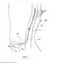 Fig. 02 - Methods of shielding implantable medical leads and implantable medical lead extensions